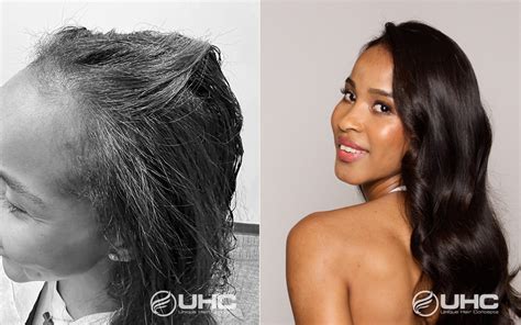 cnc hair system|Replace Your Hair .